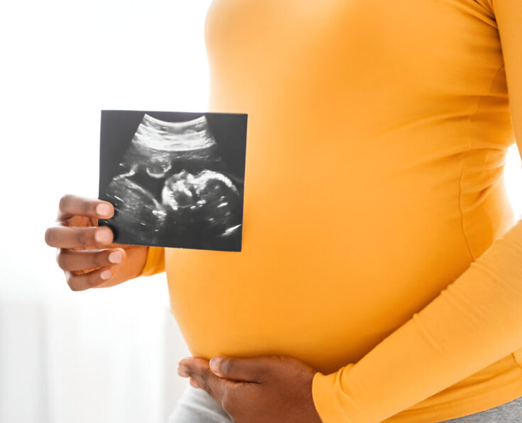 Antenatal Antenatal
